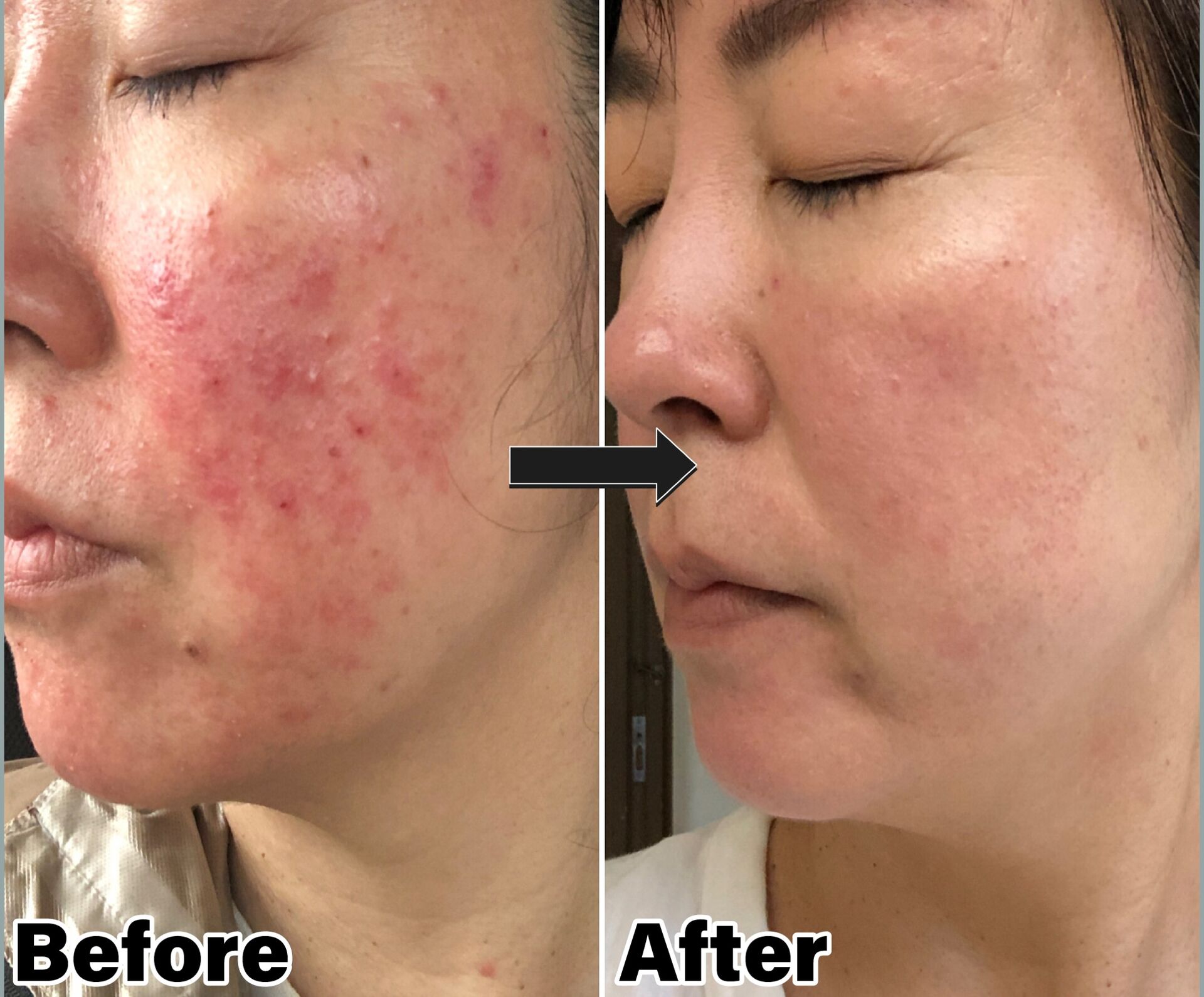 BeforeAfter (1)